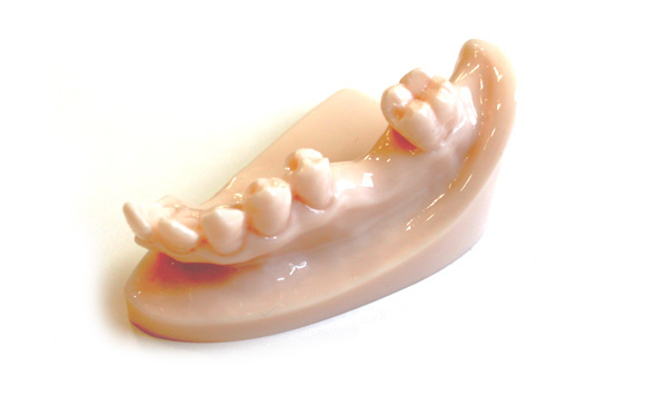 ���ʂ����Ȃ��q���[�}���u���b�W�E�ڒ��u���b�W